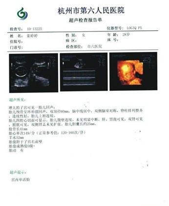 专业生产供应医用超声科B超胶片图片|专业生产