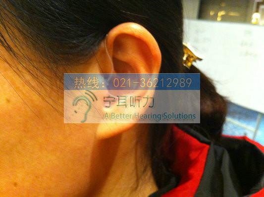 供应用于辅助听力的上海哪里买奥迪康助听器最便宜，上海第一人民医院附近哪有卖奥迪康助听器的?